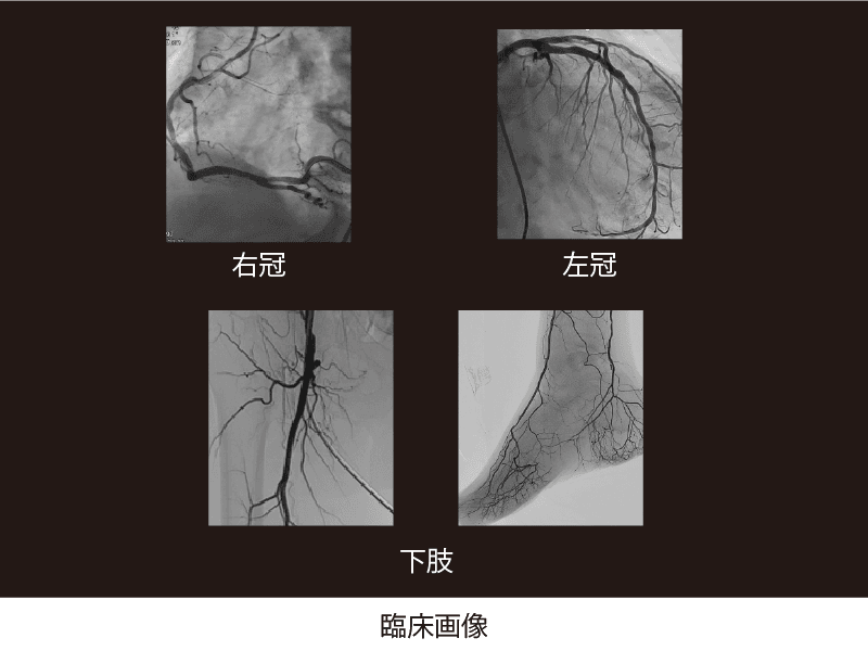 臨床画像